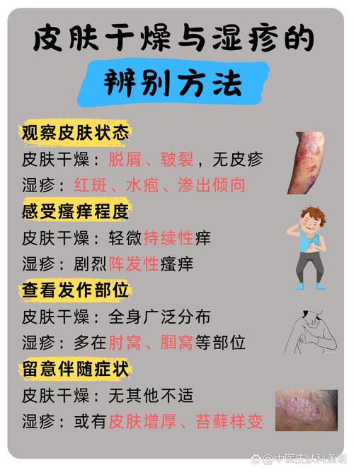 皮肤过敏为什么会痒