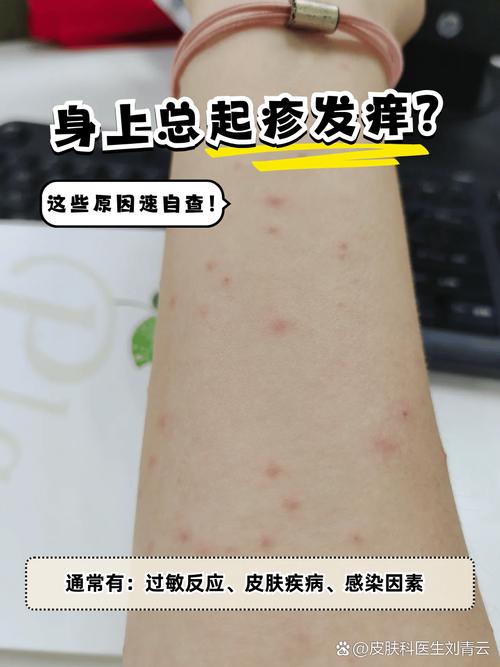 皮肤过敏为什么会痒