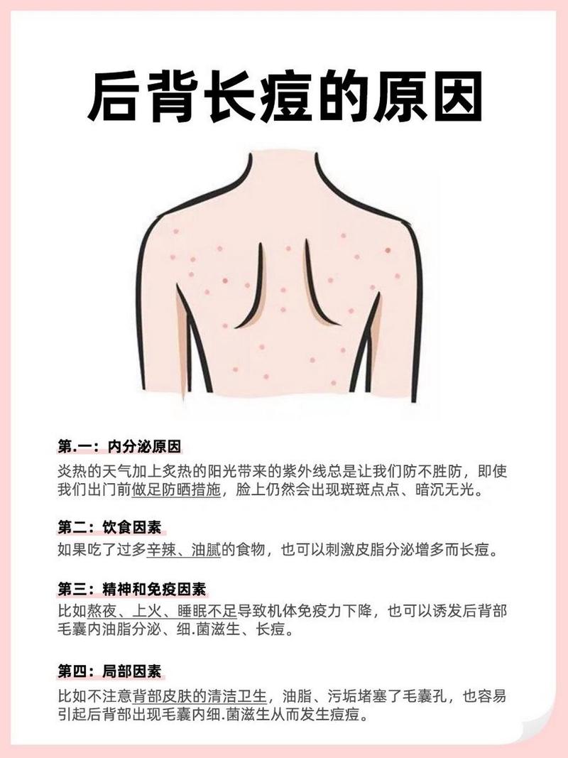 背上起痘痘什么原因