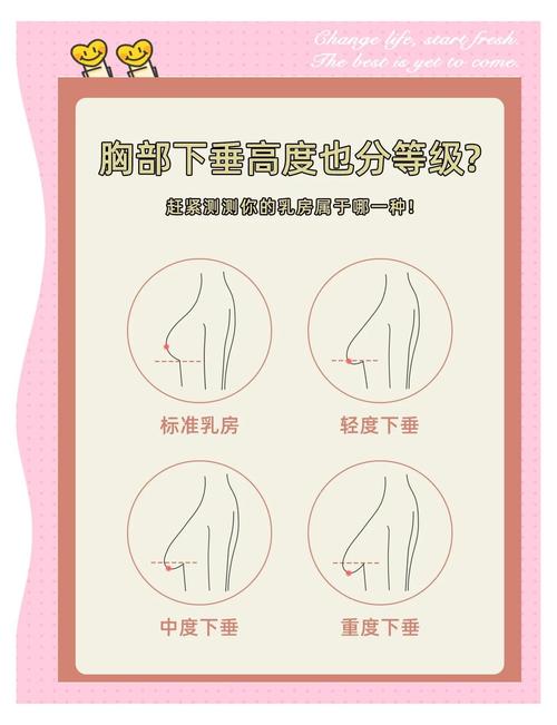 为什么会胸部下垂