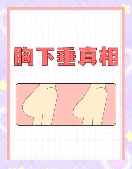 为什么会胸部下垂