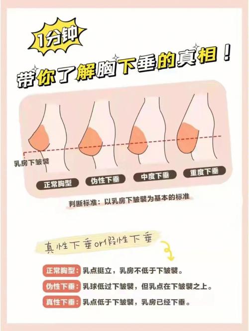 为什么会胸部下垂
