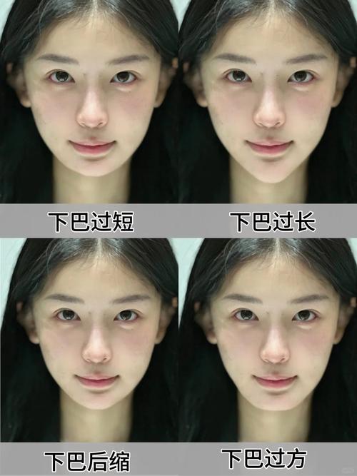 下巴为什么是平的