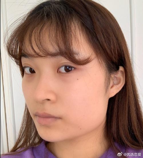 下巴为什么是平的