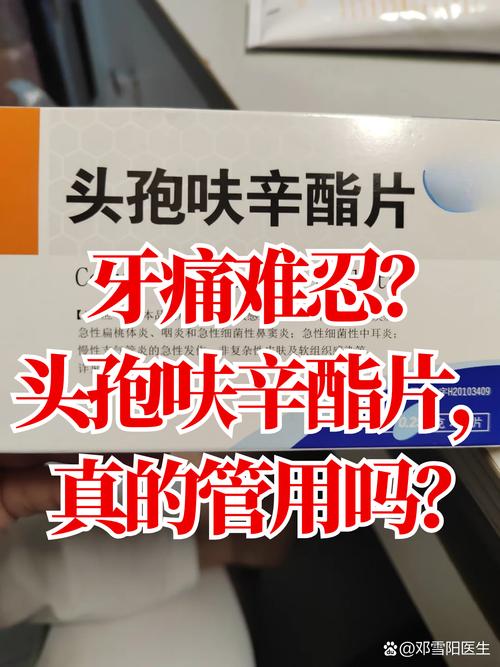 牙疼吃什么抗生素