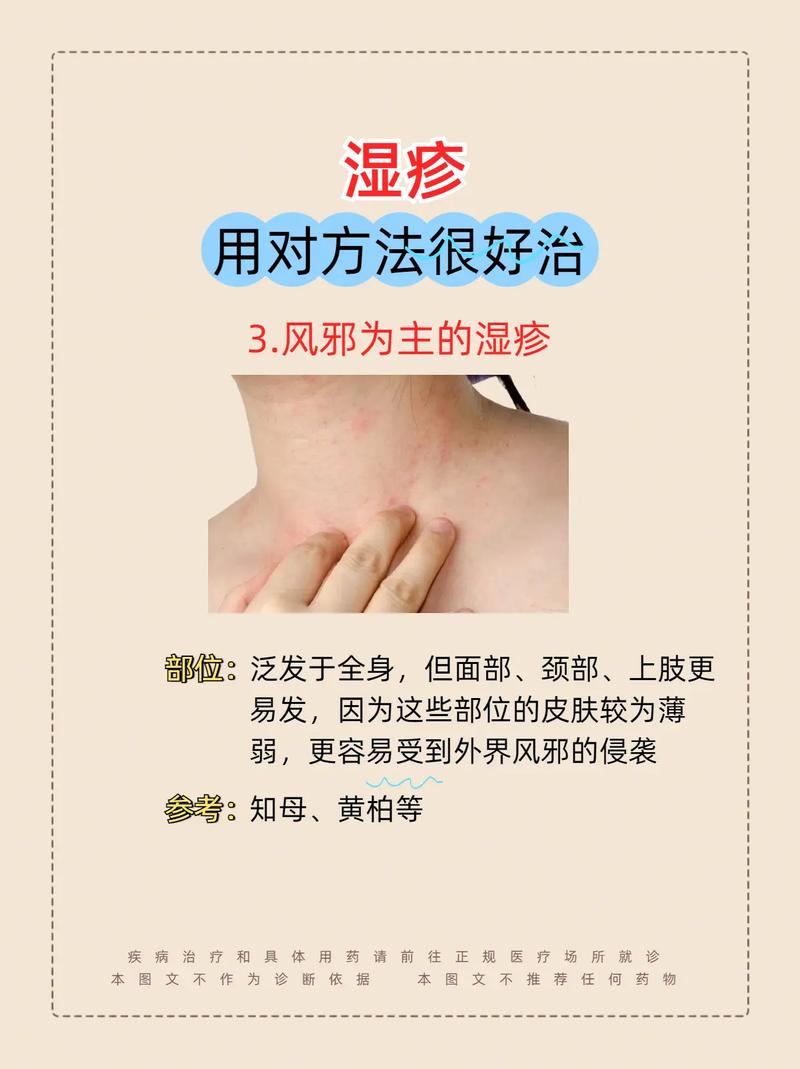 什么原因导致湿疹的