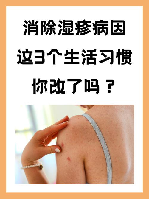 什么原因导致湿疹的