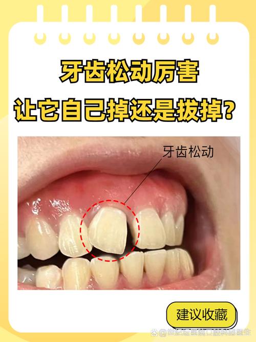 牙齿为什么松