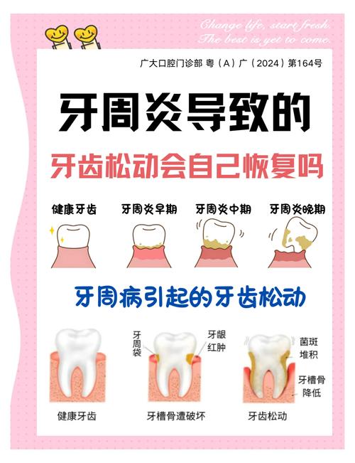 牙齿为什么松