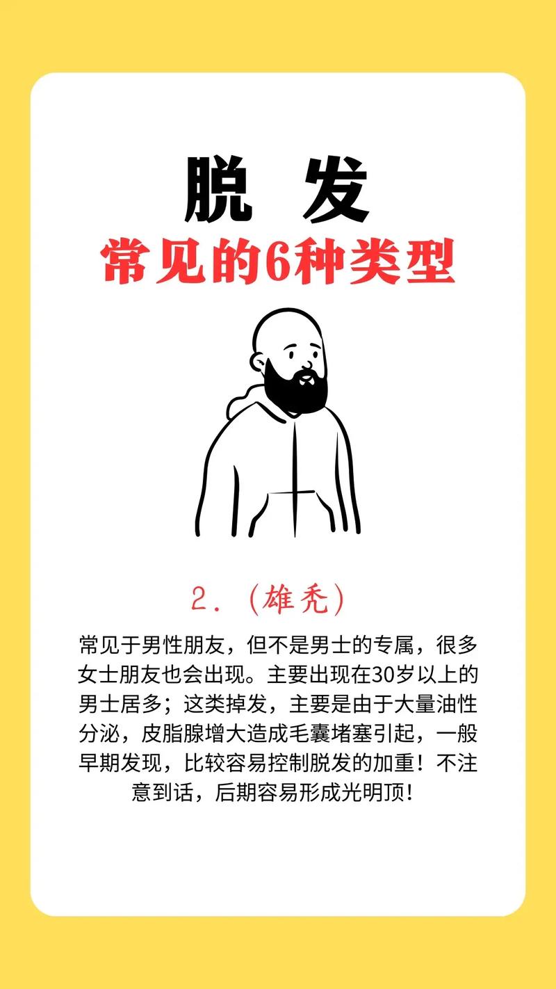 脱发是什么科