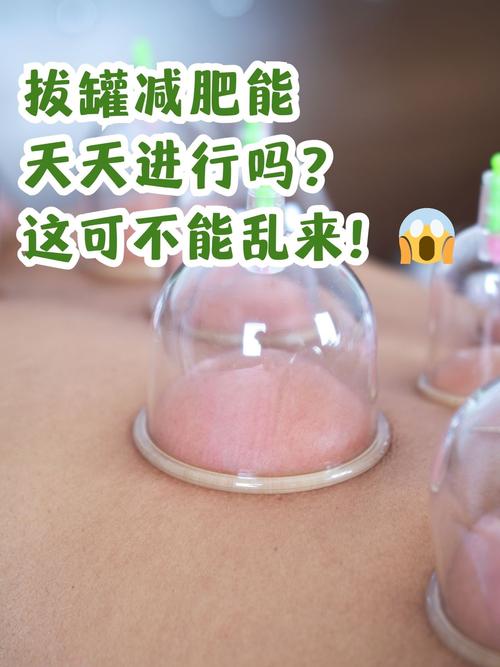 拔罐减肥摸的什么药