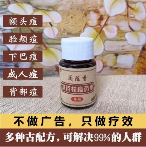中药什么祛痘