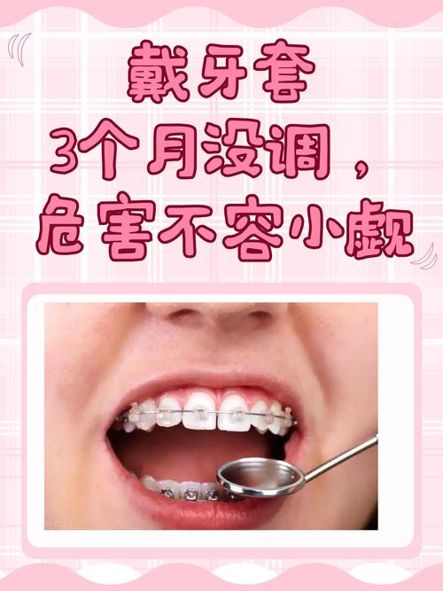 什么情况需要戴牙套