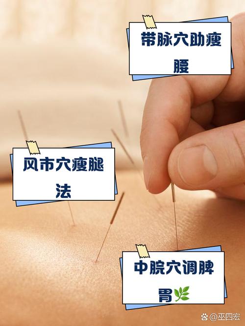 扎针减肥有什么副作用