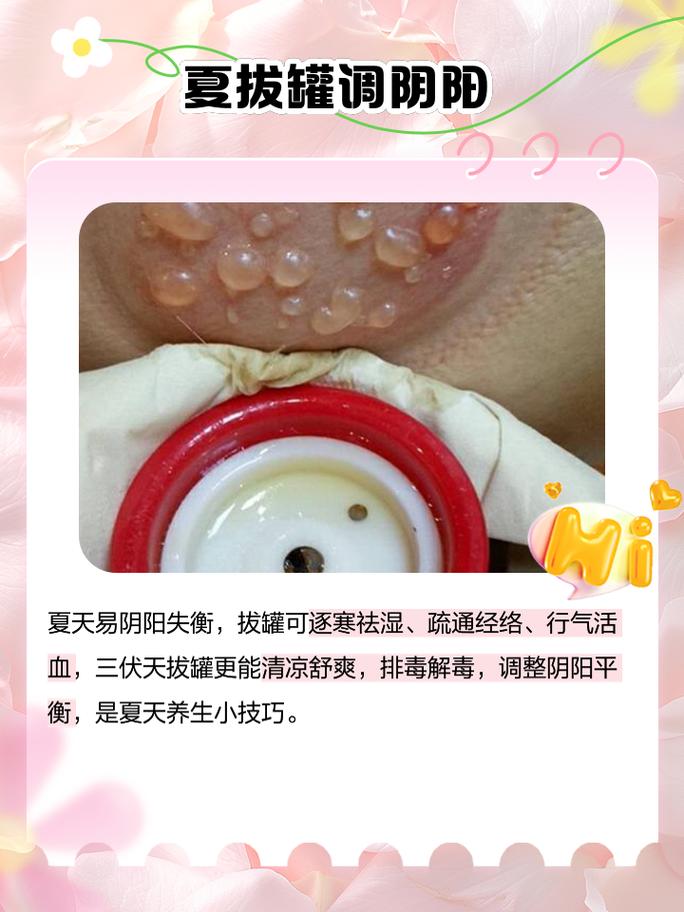 拔罐减肥吃什么好