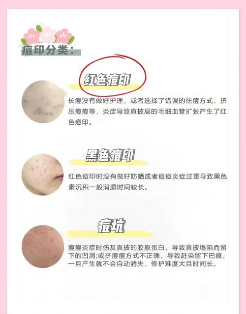 有什么办法去痘印