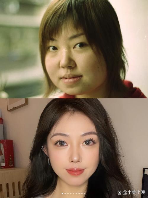 减肥瘦了为什么脸不瘦
