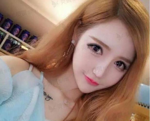 什么是锥子脸