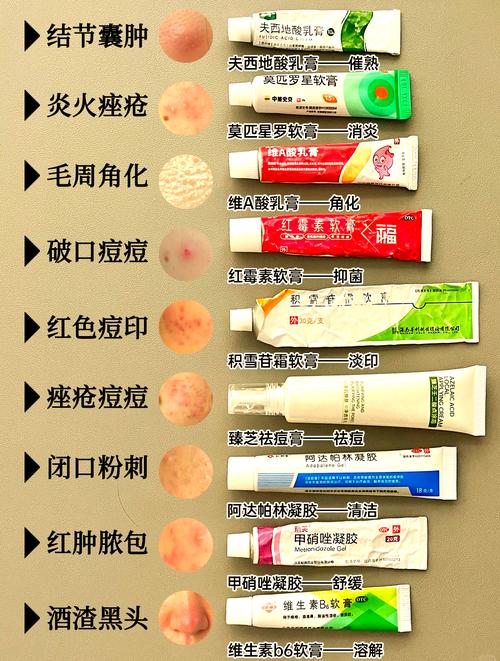 用什么能去痘