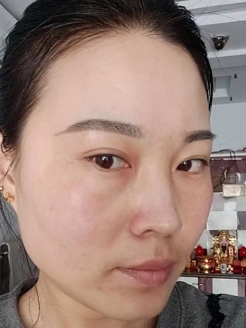 怀孕什么时候长斑