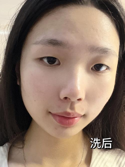 洗面奶洗到嘴巴怎么办