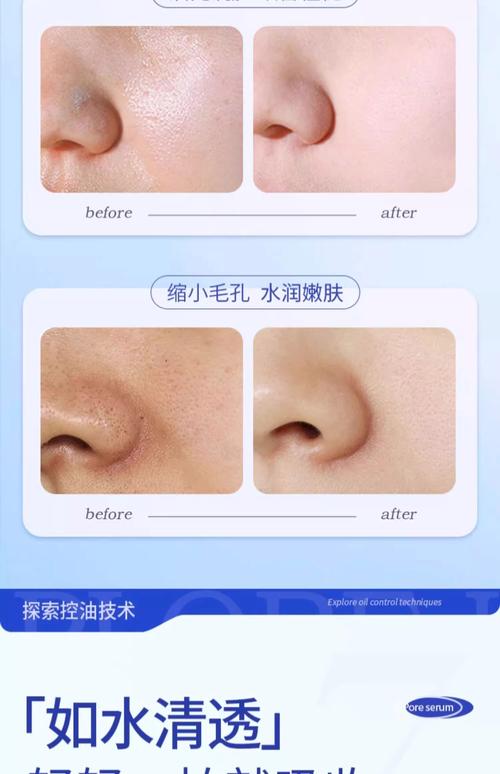 用什么能收缩毛孔