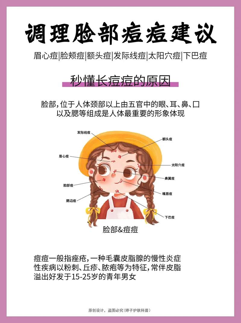 为什么痘痘长在脸上