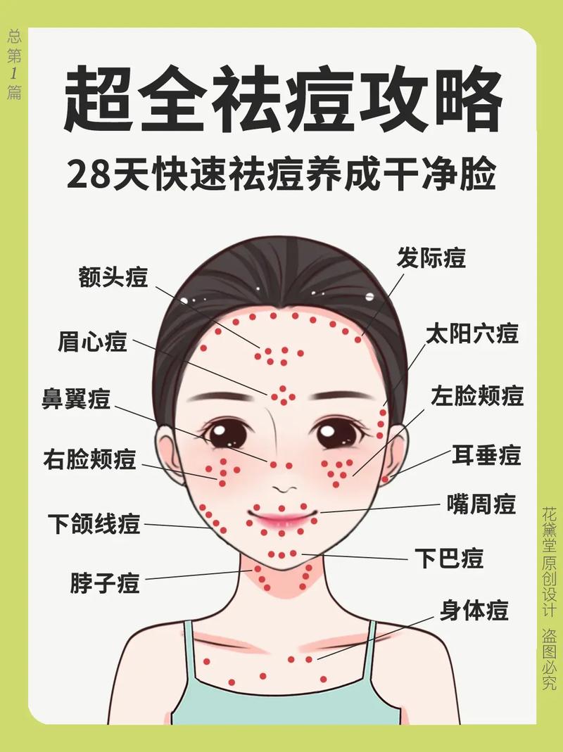 为什么痘痘长在脸上
