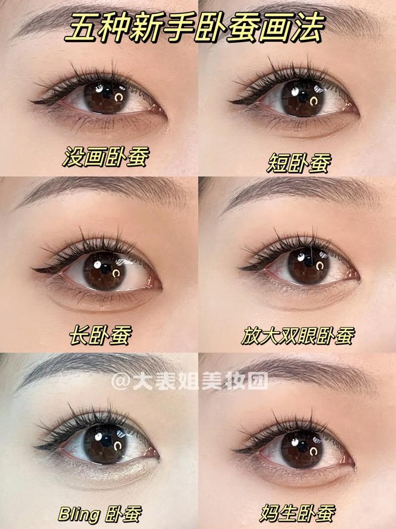 什么是卧蚕眼