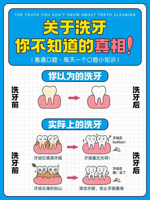 什么是x牙