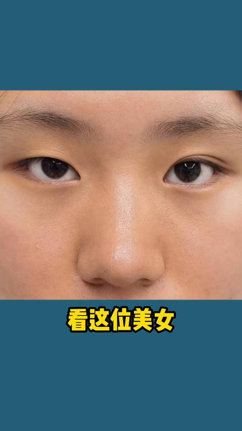 为什么眼睛一单一双