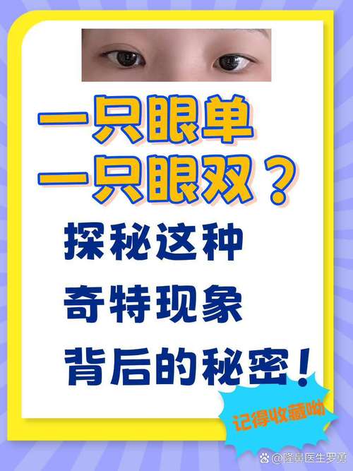 为什么眼睛一单一双