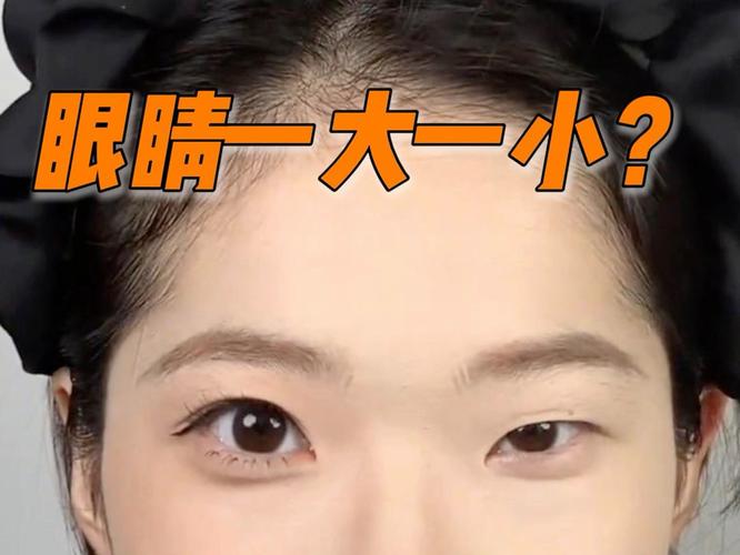 为什么眼睛一单一双