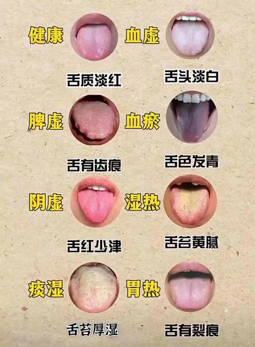 舌头有泡是什么原因
