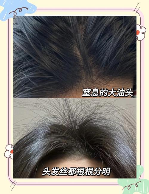 用什么洗头发去油
