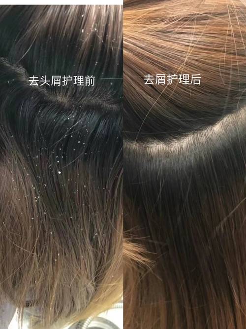 用什么洗头发去油