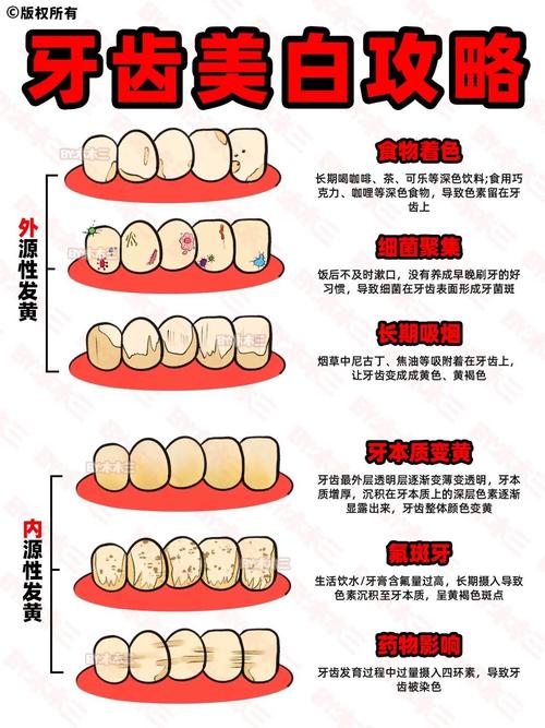 牙齿美白挂什么科