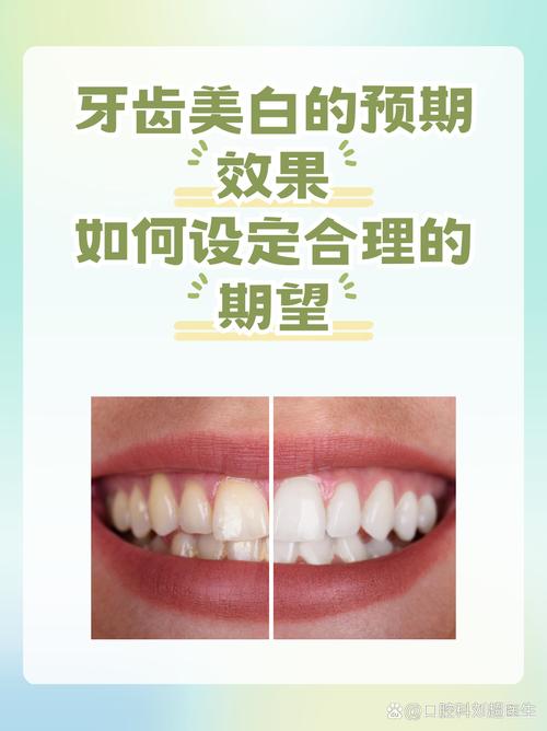 牙齿美白挂什么科