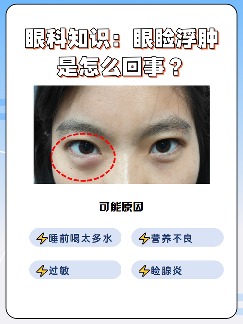 眼部浮肿是什么原因