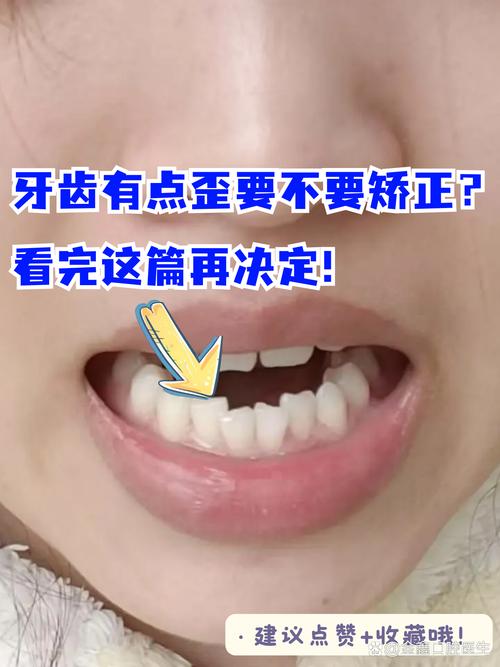 门牙为什么会长歪