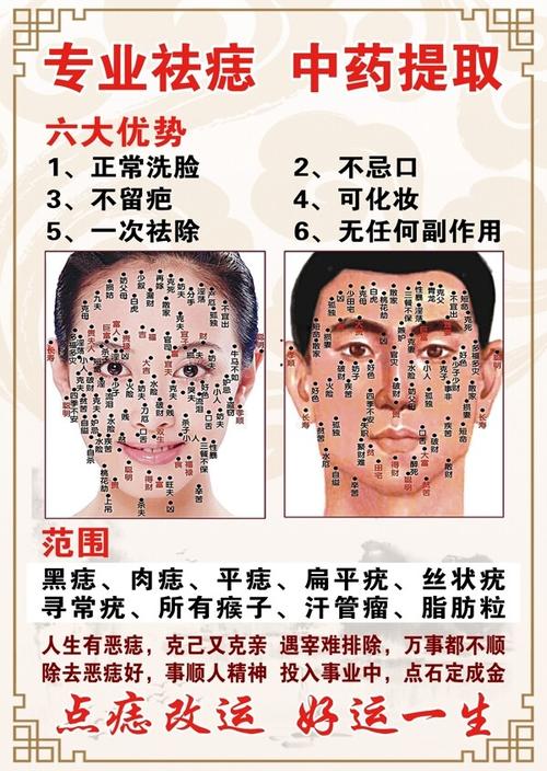 什么方法可以去痣