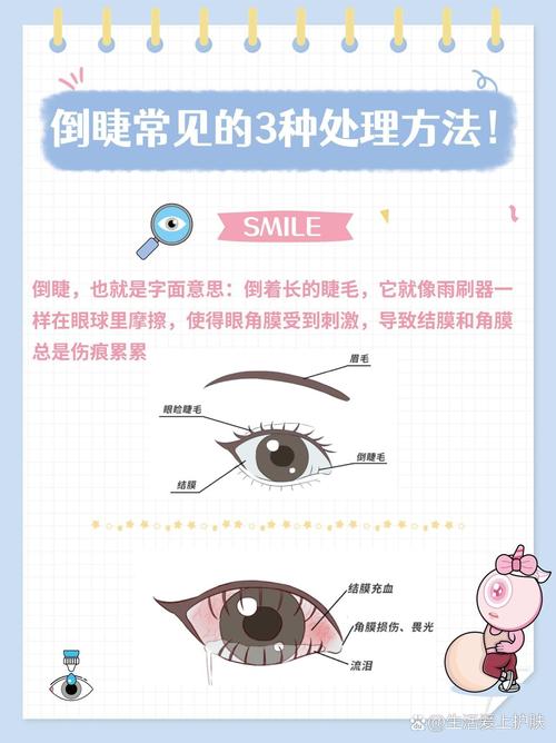 为什么会长倒睫毛