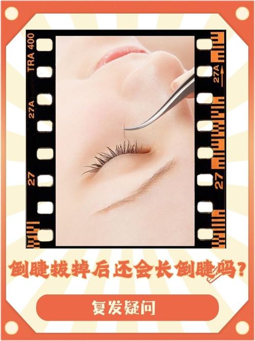 为什么会长倒睫毛