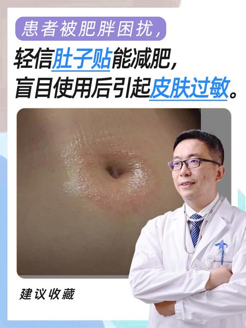 肚贴减肥有什么作用