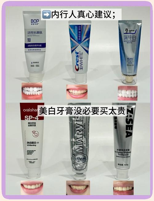 牙齿黄买什么牙膏