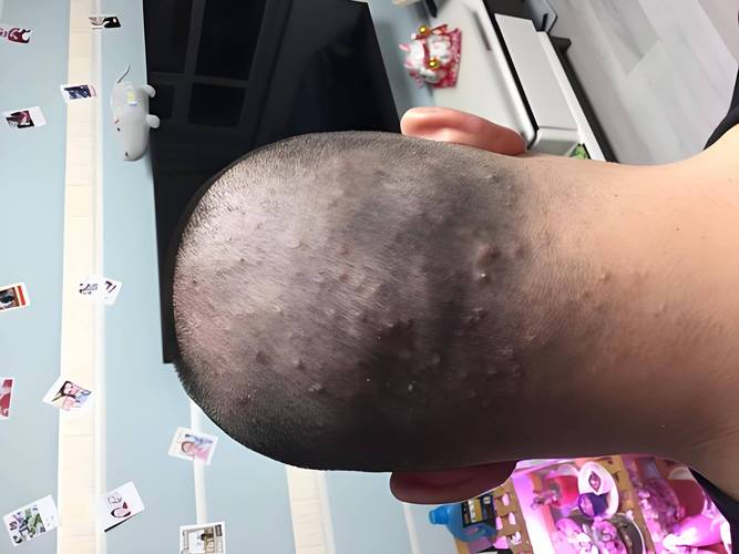 头癣挂什么科