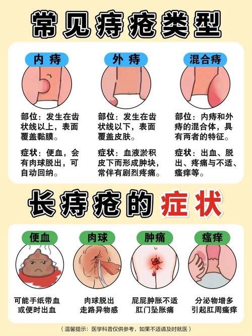 内痔在什么位置