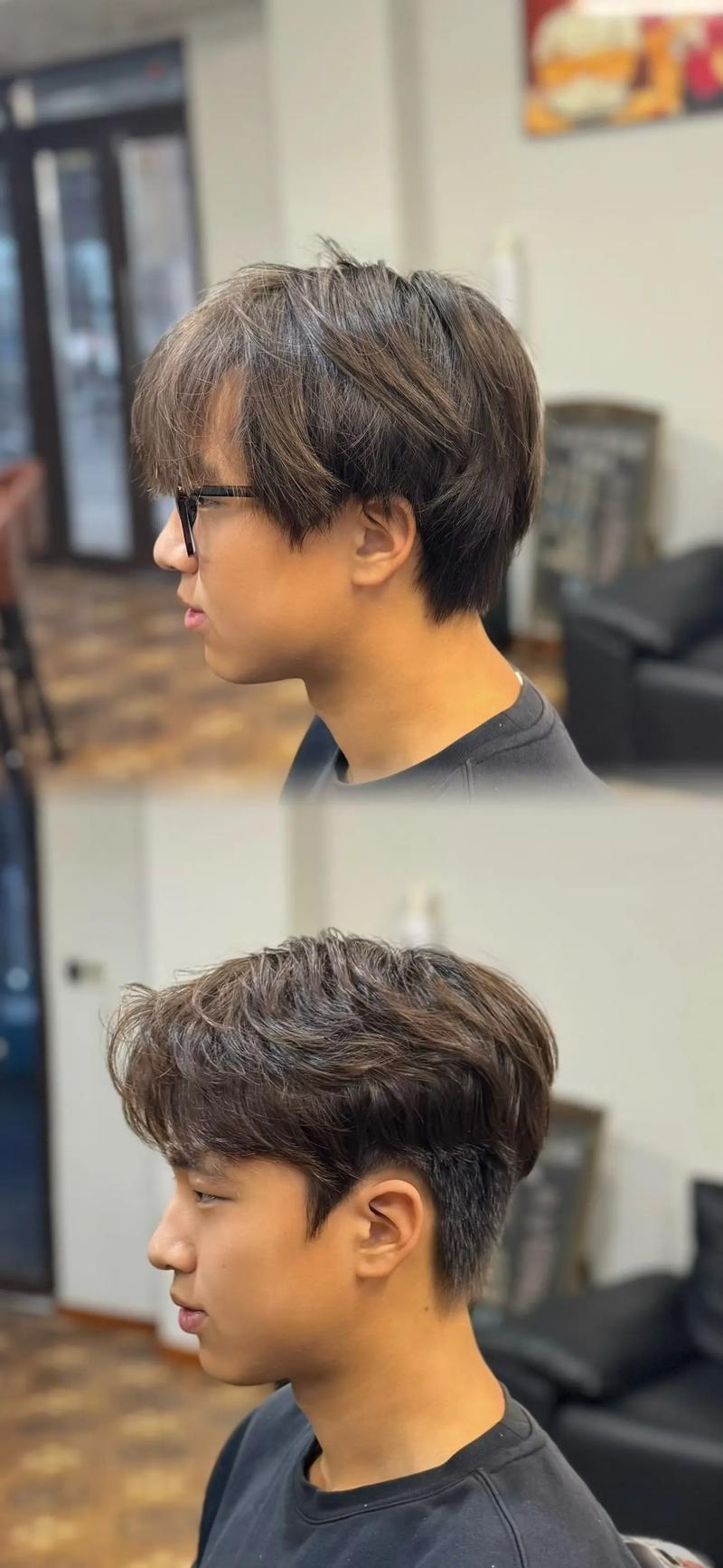 什么是高额头