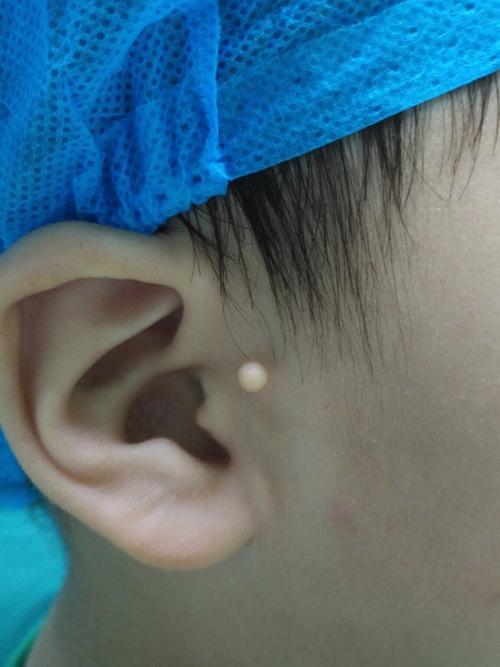 什么是附耳