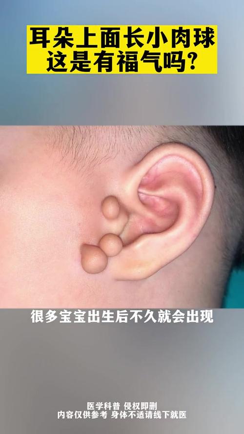 什么是附耳